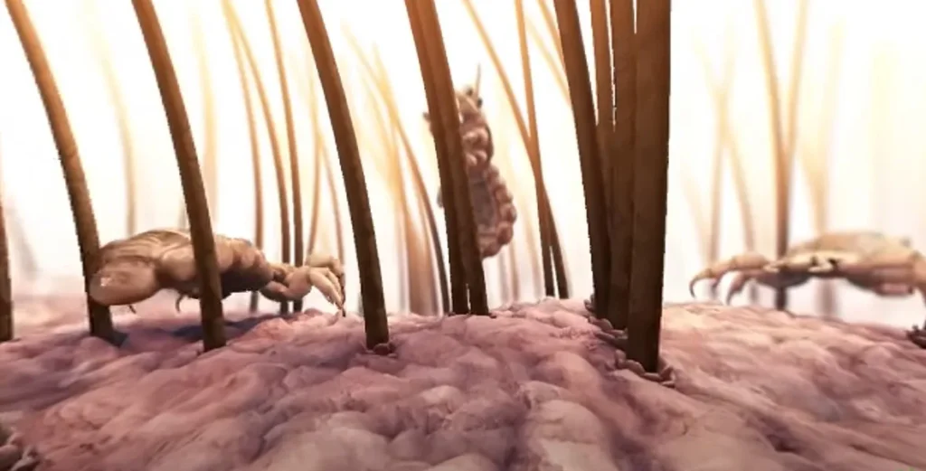 Šta znači sanjati gnjide?